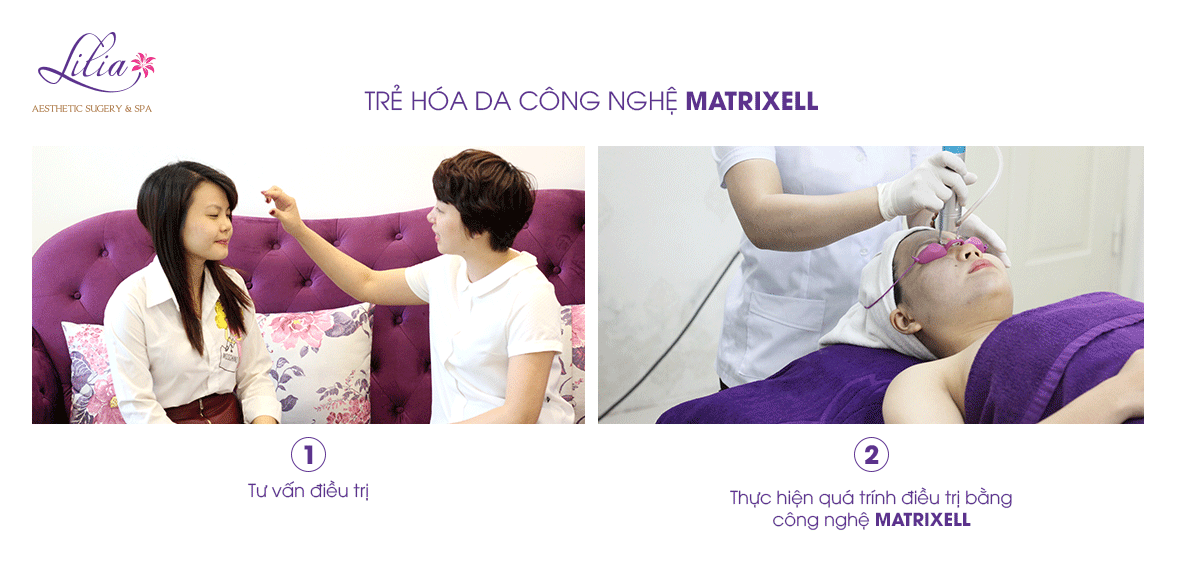 trẻ hoá da công nghệ Maxtrixell