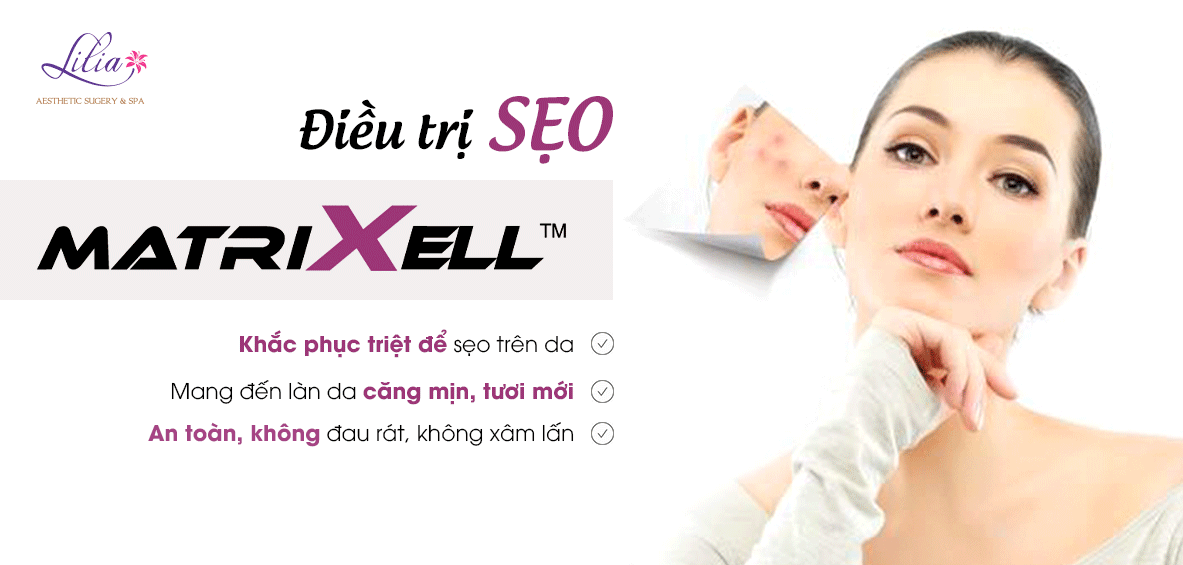 Điều trị sẹo công nghệ Matrixell