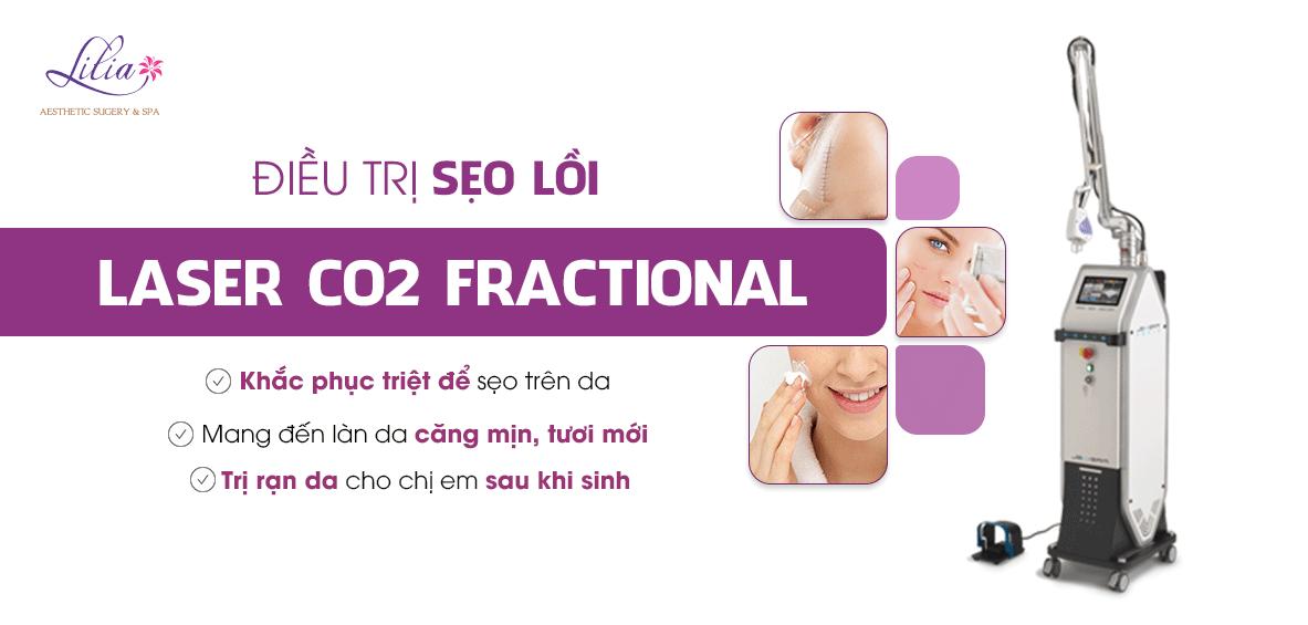 Điều trị sẹo lồi công nghệ Laser CO2 Fractional